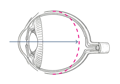 Miyosmart Illu Links V2